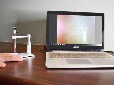 NeoGen X-DM 2MP Digital Microcirculation Microscope