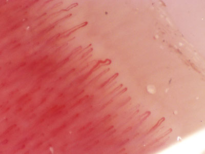 NeoGen X-DM 5MP Digital Microcirculation Microscope capillaries
