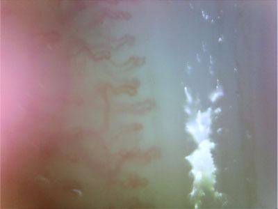 NeoGen X-DM 2MP Digital Microcirculation Microscope capillaries