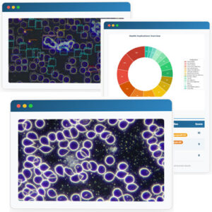 BloodWorX AI Live Blood Analysis Software
