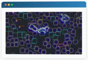 The AI Sees What the Naked Eye Misses
